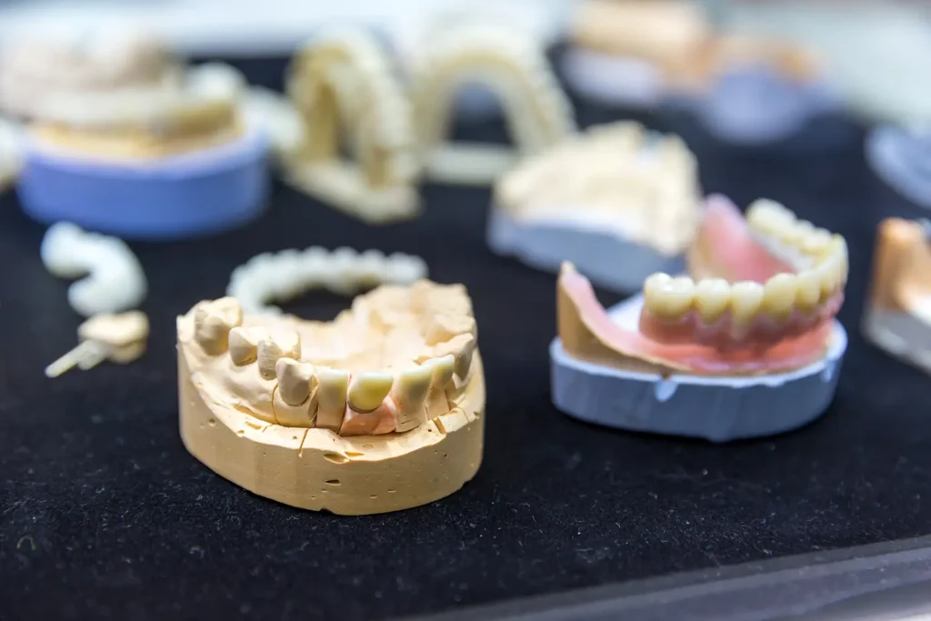Close-up of dental prosthetics and models showcasing the precision of implant-supported dentures. The Montana Center for Implants and Dentures offers expert craftsmanship and personalized dental solutions for patients.